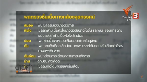 น้องเมย ภคพงศ์