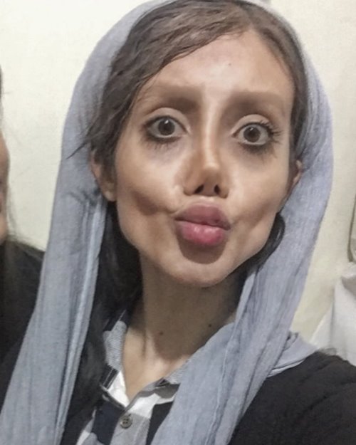 ศัลยกรรมหน้าเหมือนดารา