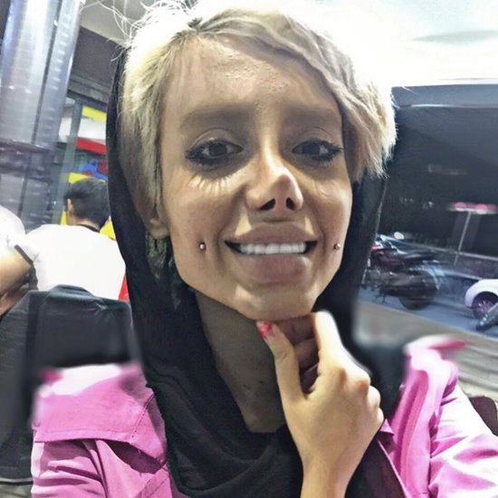 ศัลยกรรมหน้าเหมือนดารา