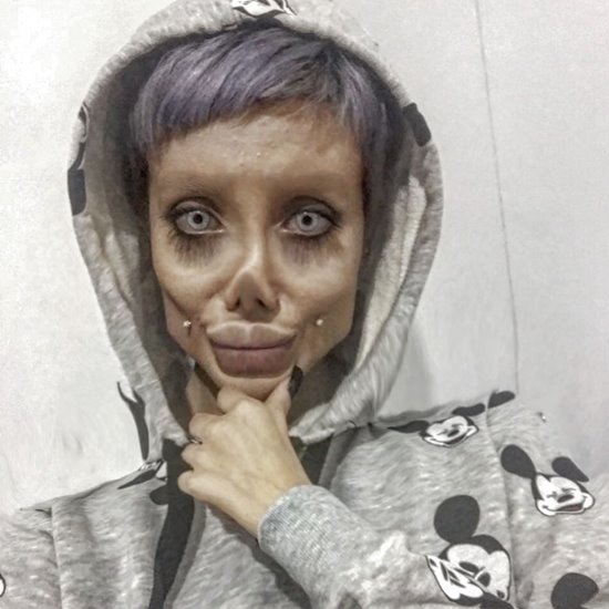 ศัลยกรรมหน้าเหมือนดารา