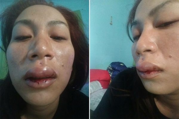 หนุ่มโต้แฟนเก่า เผยชกไปเพราะโดนรุม ยันไม่ได้ถีบสาวท้อง