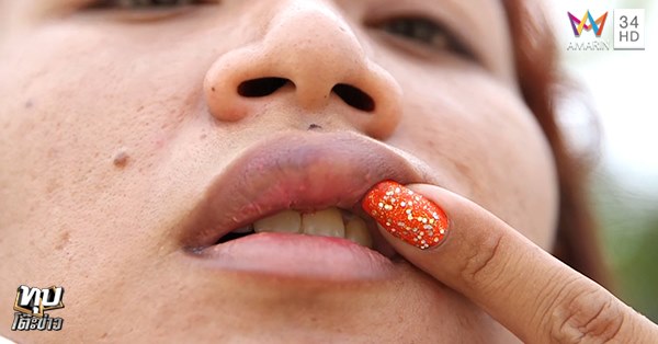 หนุ่มโต้แฟนเก่า เผยชกไปเพราะโดนรุม ยันไม่ได้ถีบสาวท้อง