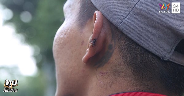 หนุ่มโต้แฟนเก่า เผยชกไปเพราะโดนรุม ยันไม่ได้ถีบสาวท้อง