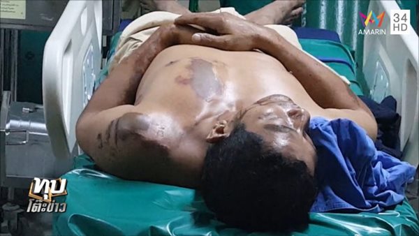 สาดน้ำกรดแฟนเก่า