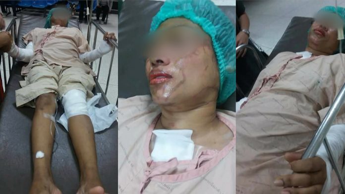 สาดน้ำกรดแฟนเก่า