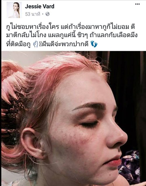เจสซี่ วาร์ด