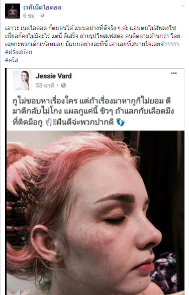 เจสซี่ วาร์ด