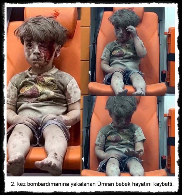 เปิดภาพล่าสุด หนูน้อยเหยื่อความโหดร้าย ผู้สะท้อนภาพความทรมานของชาวซีเรีย