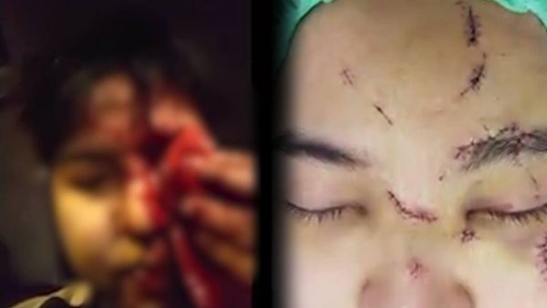 ดีเจอ้อนน้อย ดีเจทอมทุบหน้าน้องสาวบล็อกเกอร์