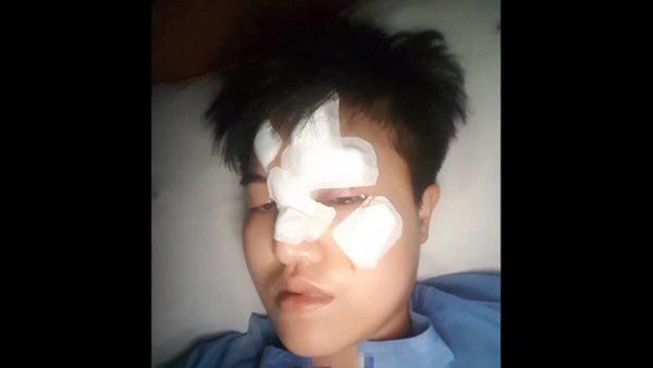 ดีเจทอมทุบหน้าสาว