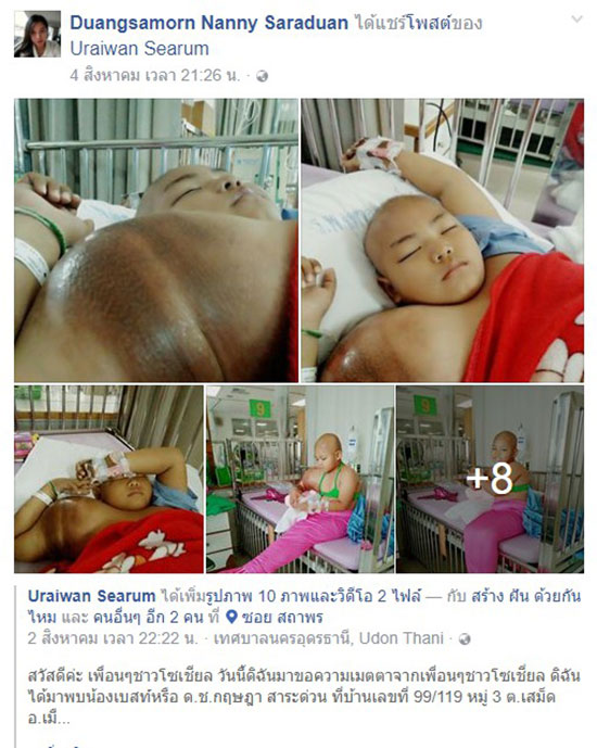 มะเร็งกระดูก