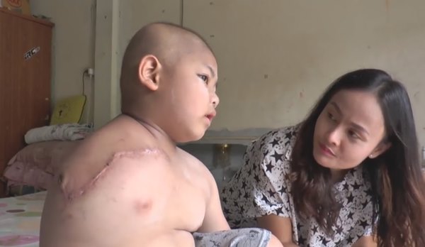 มะเร็งกระดูก