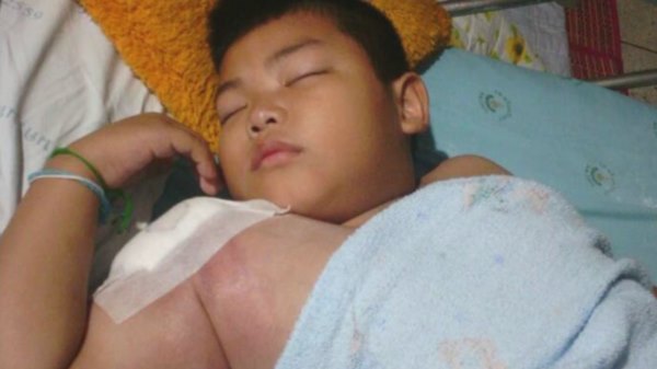 มะเร็งกระดูก