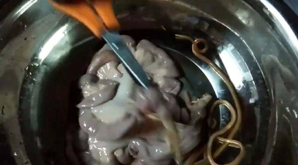 พยาธิในไส้หมู