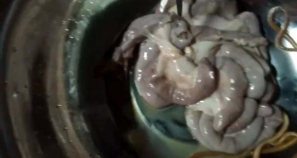 พยาธิในไส้หมู