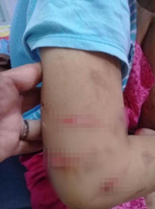 พี่เลี้ยงทำร้ายเด็กตาบอด