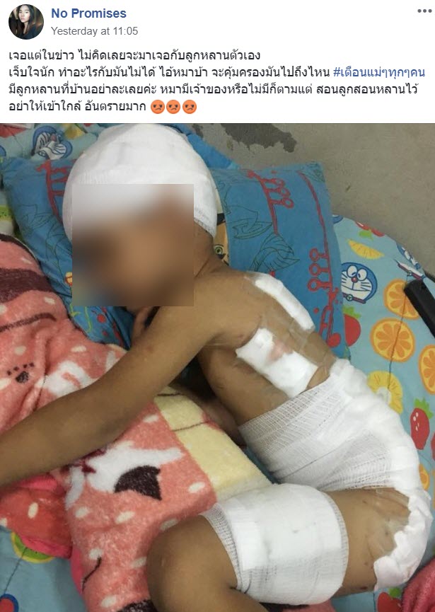 หมากัดเด็ก