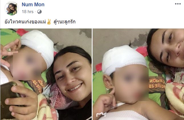 หมากัดเด็ก