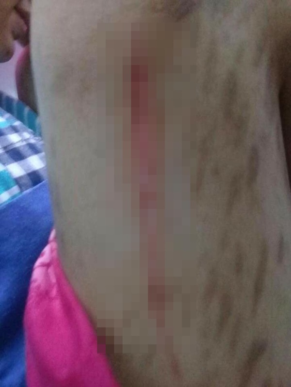 พี่เลี้ยงทำร้ายเด็กตาบอด