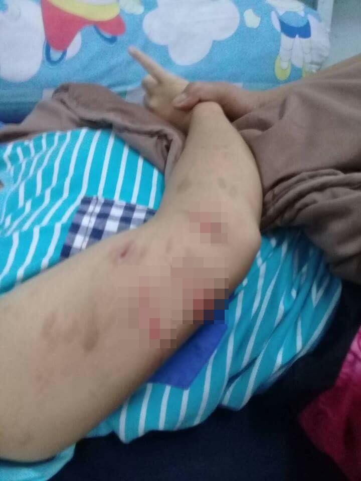 พี่เลี้ยงทำร้ายเด็กตาบอด