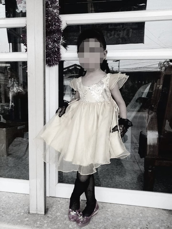 หมารุมขย้ำเด็ก 4 ขวบ