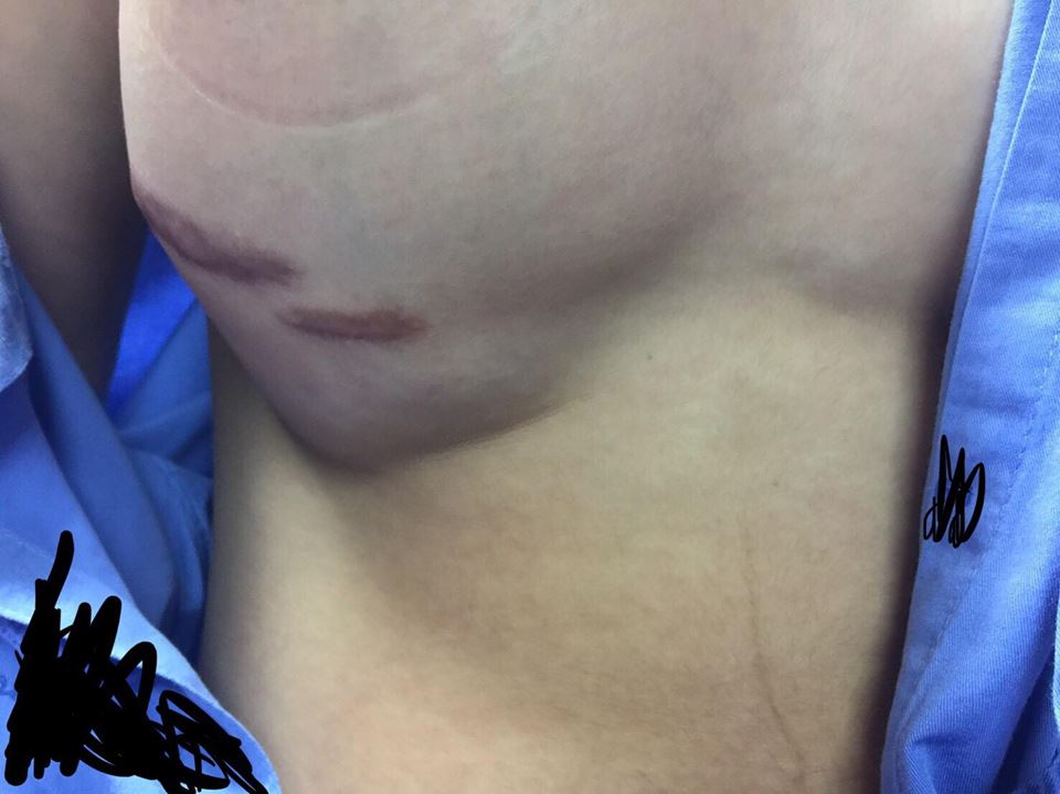 ศัลยกรรมทำพิษ