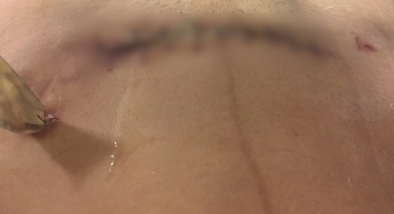 ศัลยกรรมทำพิษ