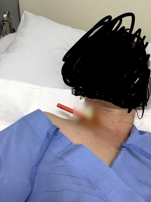 ศัลยกรรมทำพิษ