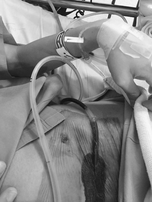 ศัลยกรรมทำพิษ