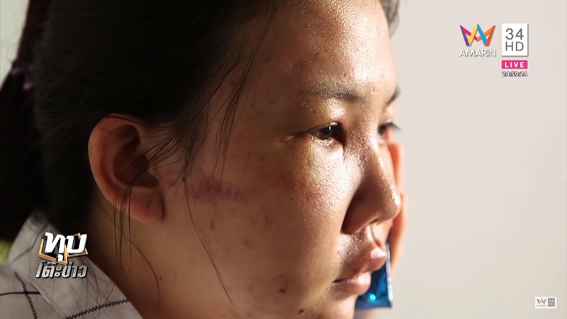 ทอมทำร้ายแฟน