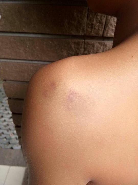 รุ่นพี่ทำร้ายรุ่นน้อง