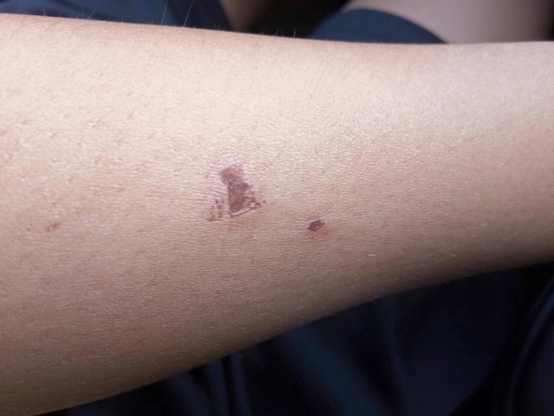 รุ่นพี่ทำร้ายรุ่นน้อง