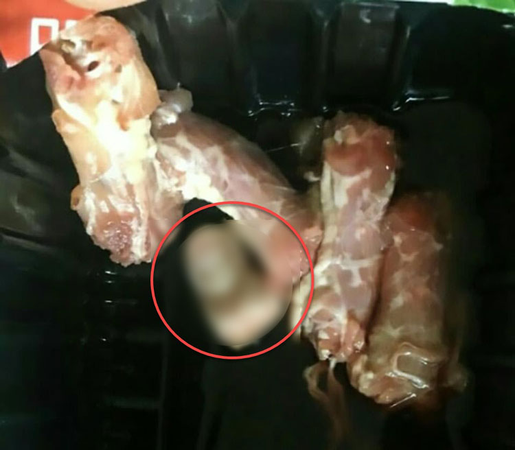 นิ้วคนปนกับเนื้อไก่