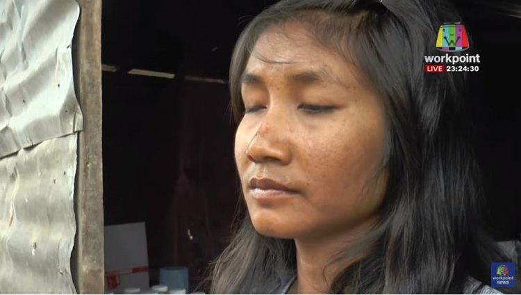 ลุงป่วยอัมพฤกษ์บริจาคดวงตาให้สาวตาบอด