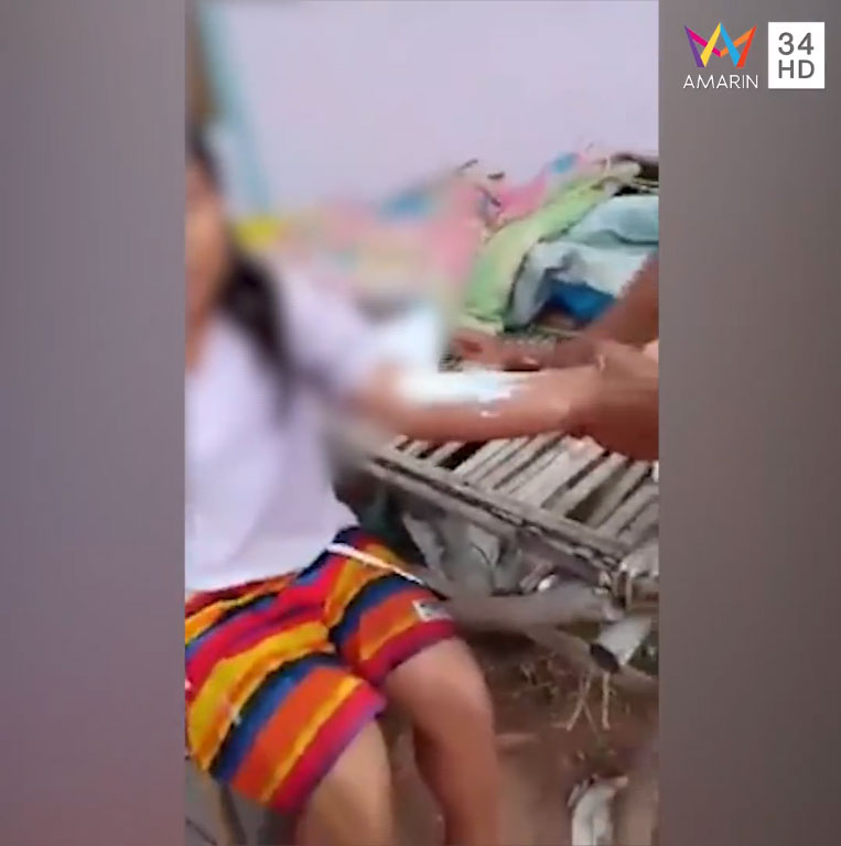 ป้าแท้ ๆ สาดน้ำร้อนใส่ 3 พ่อลูก