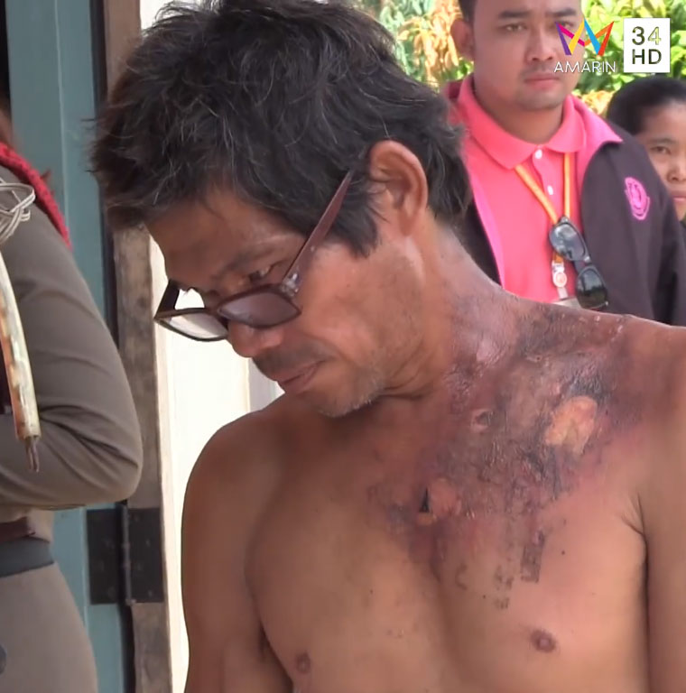 ป้าแท้ ๆ สาดน้ำร้อนใส่ 3 พ่อลูก