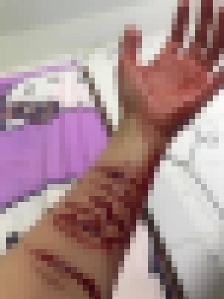 กรีดแขนตัวเอง