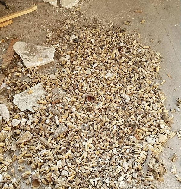 ฟันมนุษย์