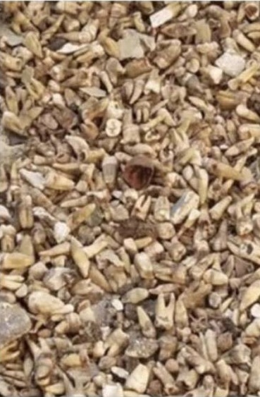 ฟันมนุษย์