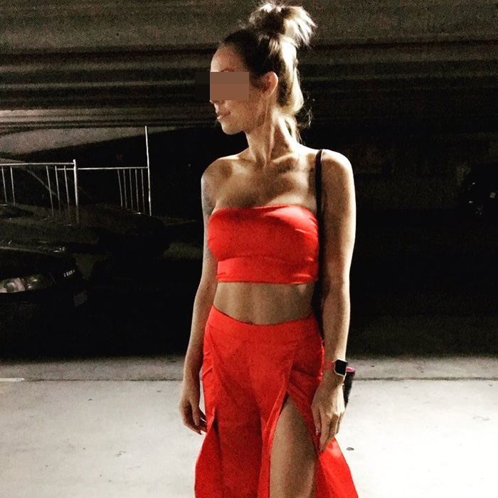 ศัลยกรรมหน้าอก