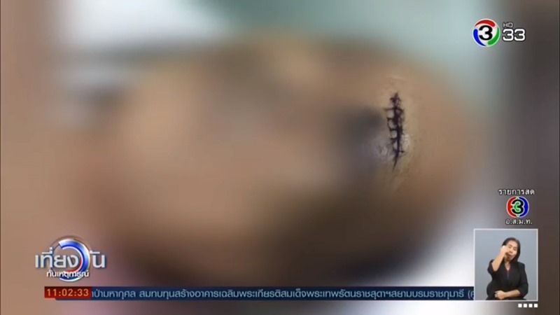 บุรุษพยาบาลชกคนไข้