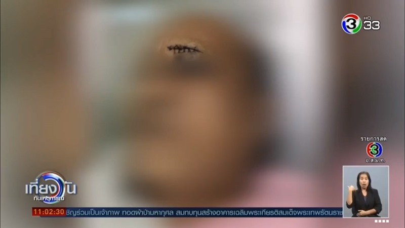 บุรุษพยาบาลชกคนไข้