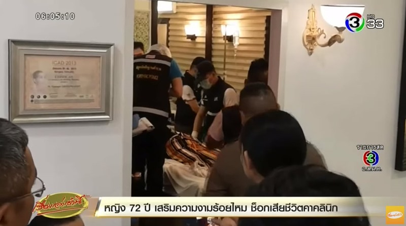 ภาวะแพ้ยาชา