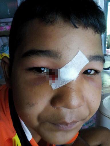 พัดลมเพดานโรงเรียนตกใส่เด็ก