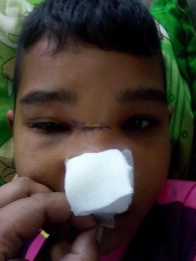 พัดลมเพดานโรงเรียนตกใส่เด็ก