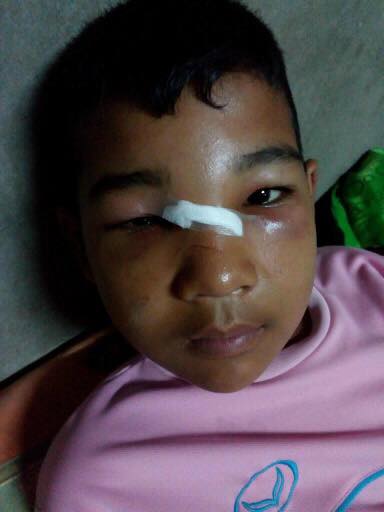 พัดลมเพดานโรงเรียนตกใส่เด็ก