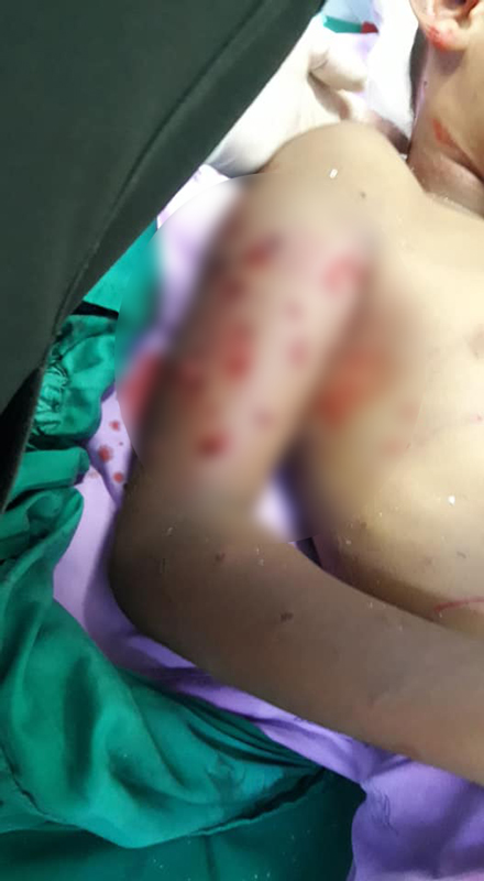 หมารุมกัดเด็ก