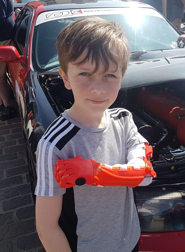 พ่อสร้างแขนกลให้ลูกพิการ