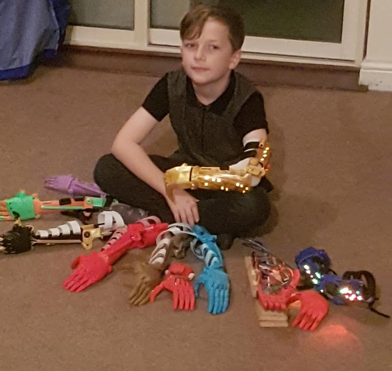 พ่อสร้างแขนกลให้ลูกพิการ