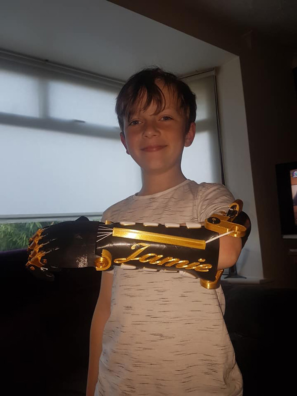 พ่อสร้างแขนกลให้ลูกพิการ